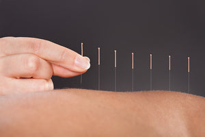 Medical Acupunture